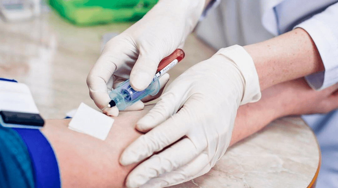 How To Prepare Before Going For A Blood Test?