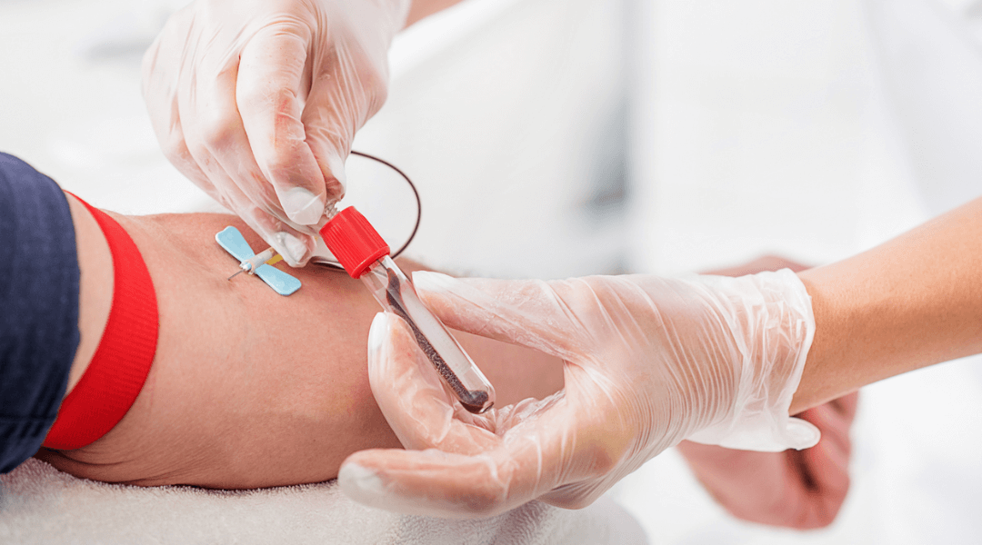 5 Important Blood Tests That Should Be Done Regularly For Better Health