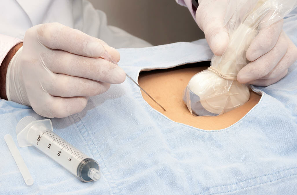 The Needle That Knows Where It’s Going: Inside Acorn’s Injection Clinic