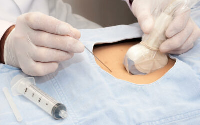 The Needle That Knows Where It’s Going: Inside Acorn’s Injection Clinic