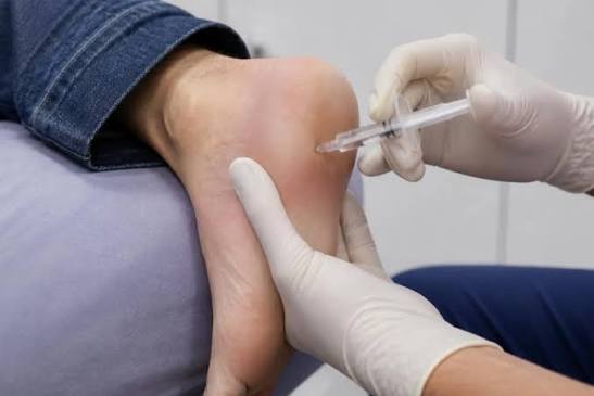 Heel Pain on the First Step of the Day: What Is Really Going On, and What Actually Helps